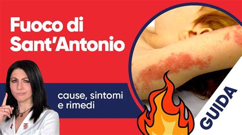 fuoco di sant'antonio in english.